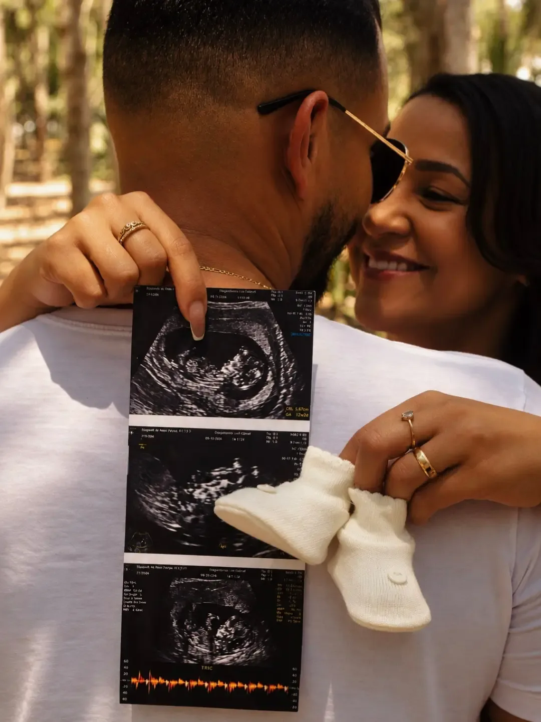 Casal se abraçando e segurando uma imagem de ultrassom e um par de sapatinhos.